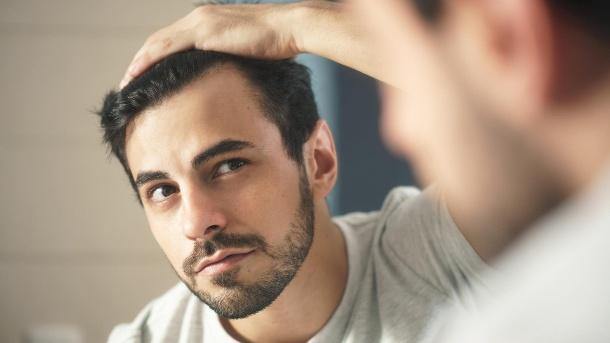 Un regard sur la calvitie masculine - Natucain